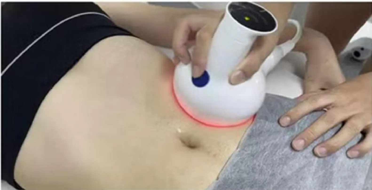 Struggling with stubborn fat even after jogging and dieting